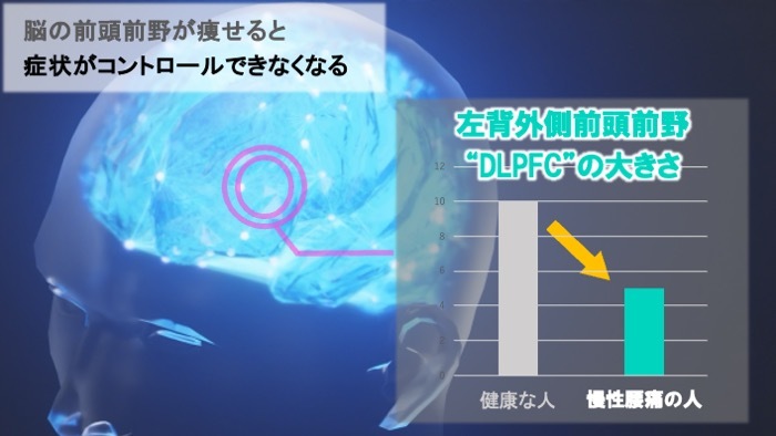 DLPFC