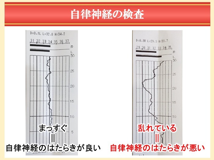 自律神経の検査