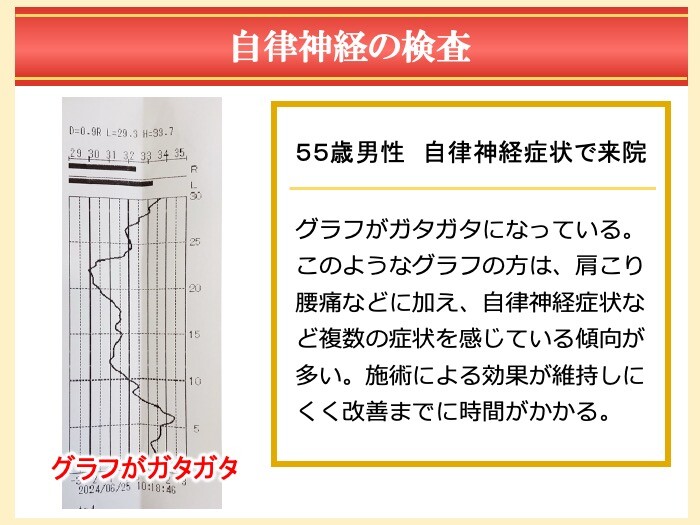 自律神経の検査